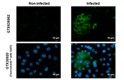 Anti-Chikungunya virus nsP2 antibody [HL1488] used in Immunocytochemistry/ Immunofluorescence (ICC/IF). GTX636962